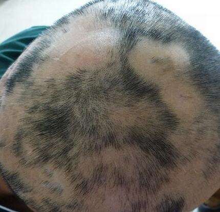 �ճ�������Ӧ�����Ԥ����ͺ�Ϻ�