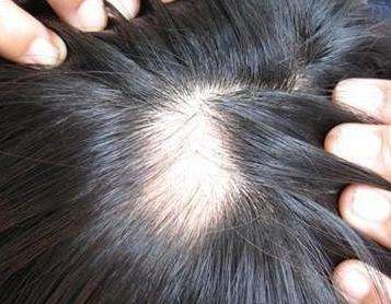 ͻȻ��ͺ��ʲôԭ��