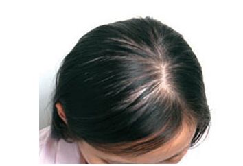 �ѷ��Ĳ�������Щ