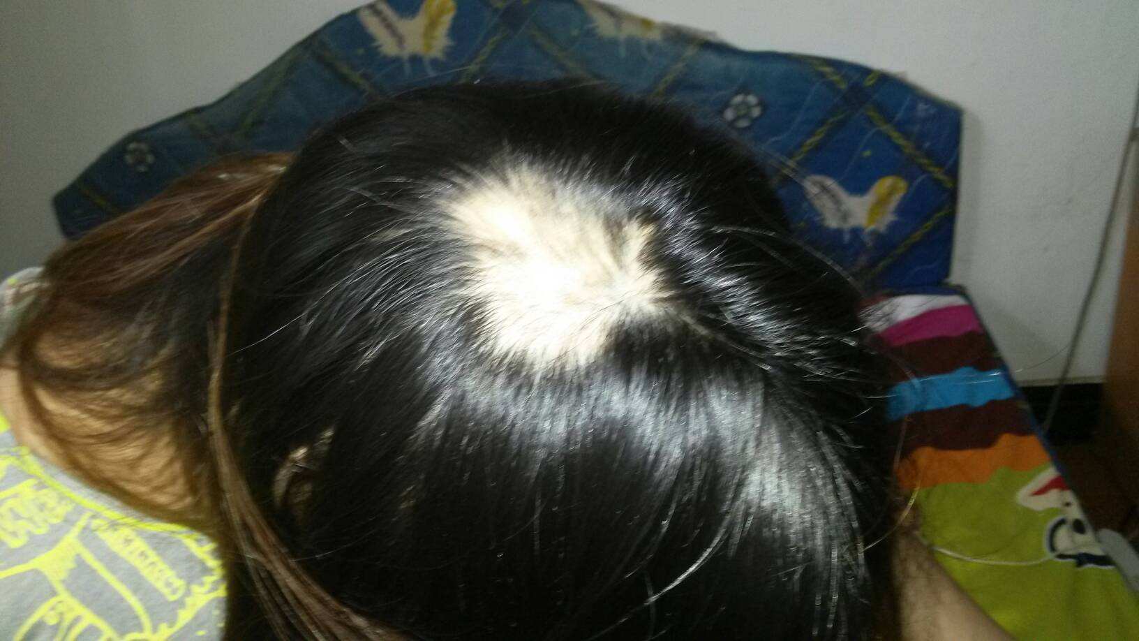 Ů��ͺ����ԭ����ʲô