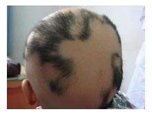 ˵һ˵С���ѷ���֢״����