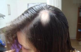 �ϵ�ͷ����ʲôԭ��