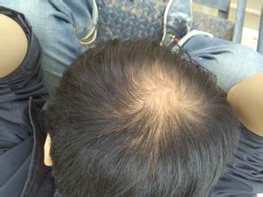 �����ѷ���ԭ����ʲô