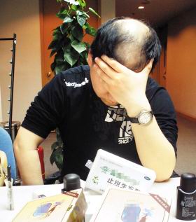 �ϵ�ͷ����ʲôԭ��