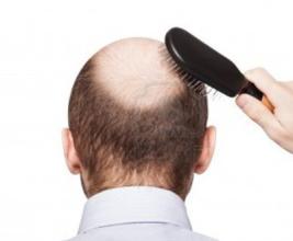 ��ʳ��Ӱ���ѷ���