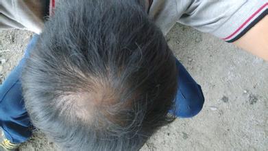 ͷ���ѷ�������ô����