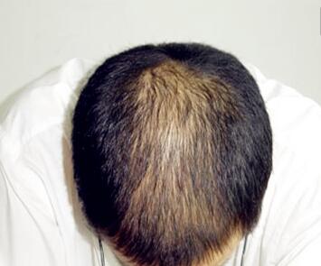 �����ѷ���֢״����Щ