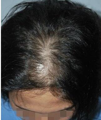 �շ��ѷ���ԭ������Щ