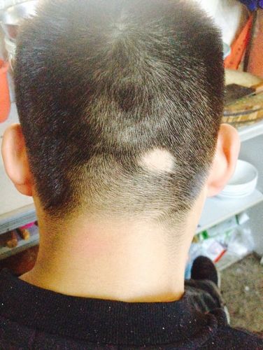 �ѷ���Σ��������Щ