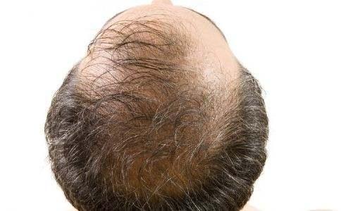 ��ͺ��֬���Ե�����ʲô��ͬ